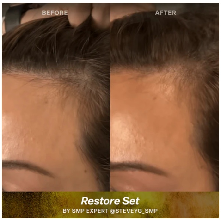 restore 2